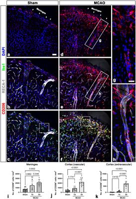 Infiltration of meningeal macrophages into the Virchow–Robin space after ischemic stroke in rats: Correlation with activated PDGFR-β-positive adventitial fibroblasts